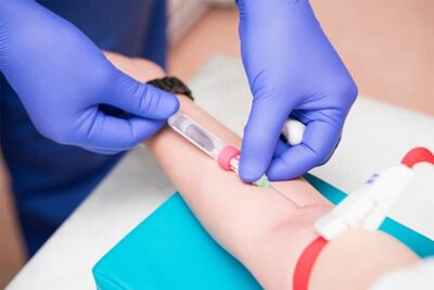 Αιμοληψία Κατ' οίκον Θεσσαλονίκη